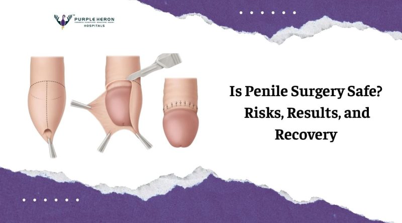 penile surgery