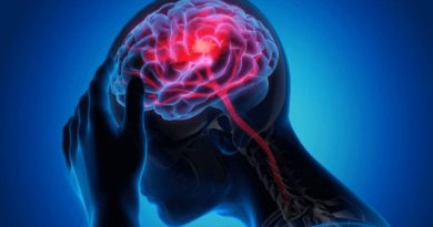 Neurology treatment in Jaipur