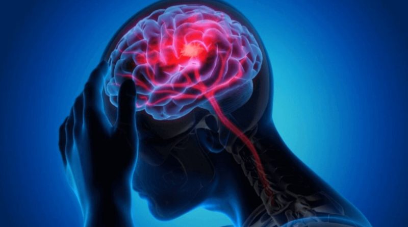 Neurology treatment in Jaipur