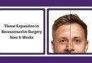 Best Reconstructive Surgery Hospital in India