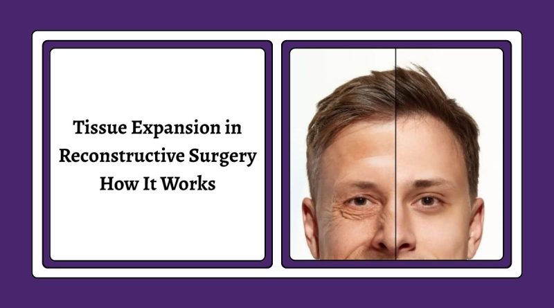 Best Reconstructive Surgery Hospital in India