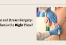 Best Breast Surgery in Jaipur
