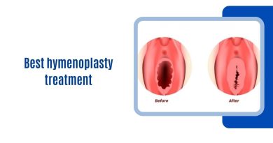 Best hymenoplasty treatment
