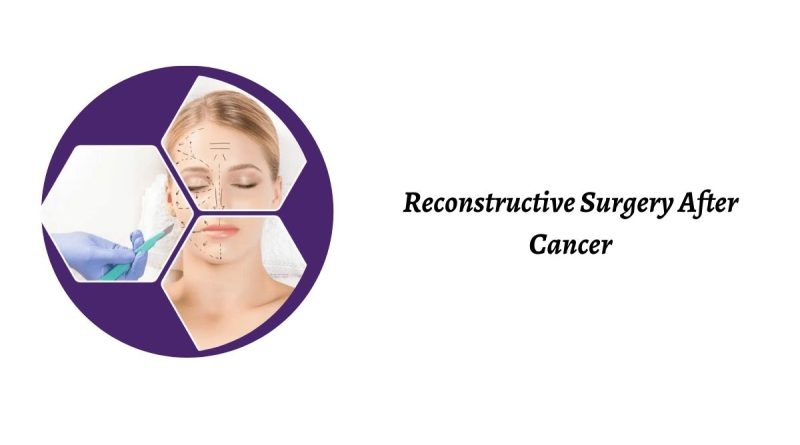 Best Reconstructive Surgery Hospital in India