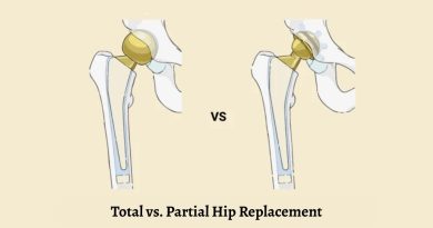 Total Hip Replacement Surgeon in Jaipur