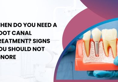 When Do You Need a Root Canal Treatment? Signs You Should Not Ignore