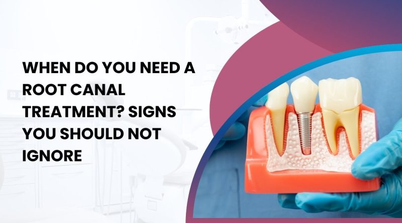 When Do You Need a Root Canal Treatment? Signs You Should Not Ignore