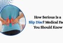 How Serious Is a Slip Disc? Medical Facts You Should Know