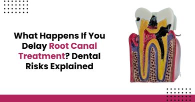 What Happens If You Delay Root Canal Treatment? Dental Risks Explained
