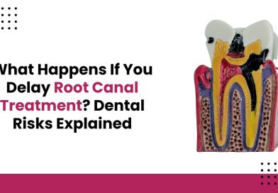What Happens If You Delay Root Canal Treatment? Dental Risks Explained