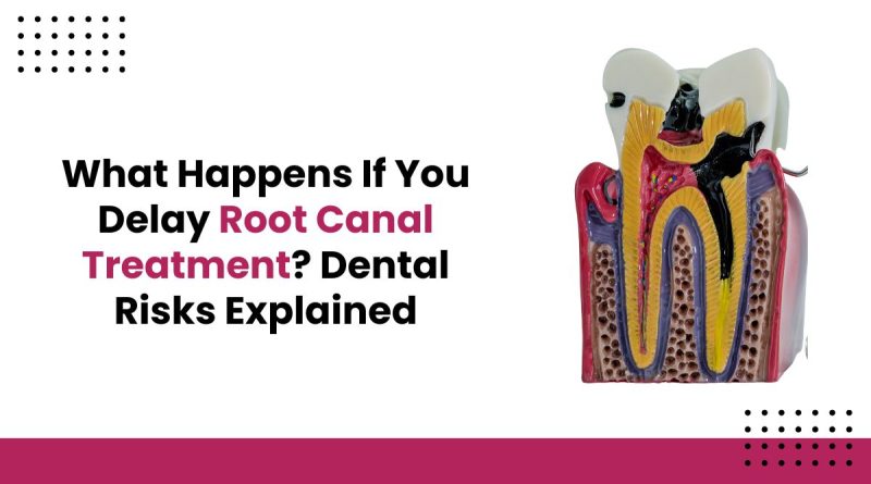 What Happens If You Delay Root Canal Treatment? Dental Risks Explained