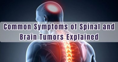 Common Symptoms of Spinal and Brain Tumors Explained