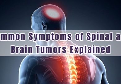 Common Symptoms of Spinal and Brain Tumors Explained