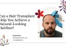 Can a Hair Transplant Help You Achieve a Natural-Looking Hairline?