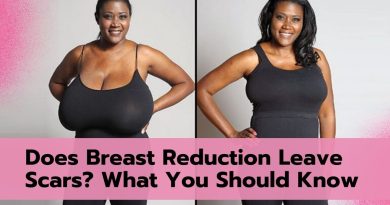 Does Breast Reduction Leave Scars? What You Should Know