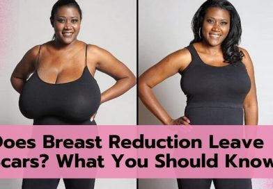 Does Breast Reduction Leave Scars? What You Should Know