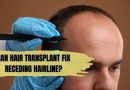 Can Hair Transplant Fix Receding Hairline?