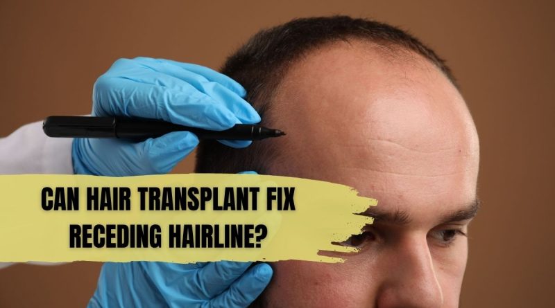 Can Hair Transplant Fix Receding Hairline?
