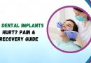Do Dental Implants Hurt? Pain & Recovery Guide