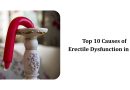 Top 10 Causes of Erectile Dysfunction in Men