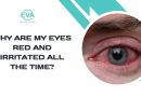 Why Are My Eyes Red and Irritated All the Time?