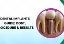 Dental Implants Guide 2026: Cost, Procedure & Results