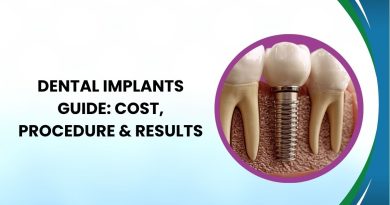Dental Implants Guide 2026: Cost, Procedure & Results