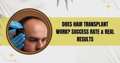 Does Hair Transplant Work? Success Rate & Real Results