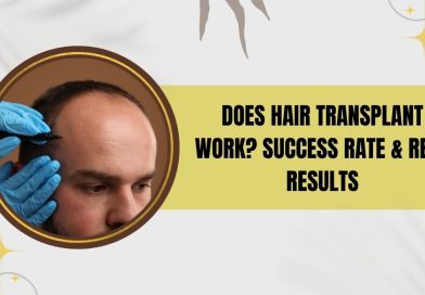 Does Hair Transplant Work? Success Rate & Real Results