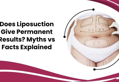 Does Liposuction Give Permanent Results? Myths vs Facts Explained