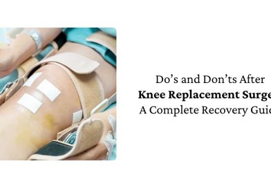 Do’s and Don’ts After Knee Replacement Surgery: A Complete Recovery Guide