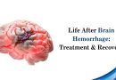 Life After Brain Hemorrhage: Treatment & Recovery