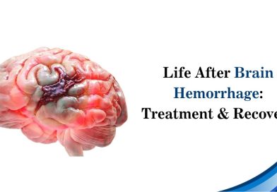 Life After Brain Hemorrhage: Treatment & Recovery