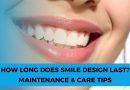 How Long Does Smile Design Last? Maintenance & Care Tips