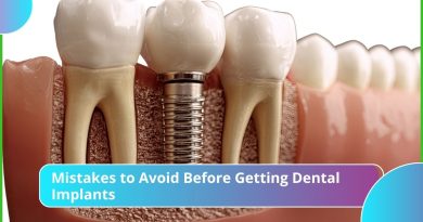 Mistakes to Avoid Before Getting Dental Implants