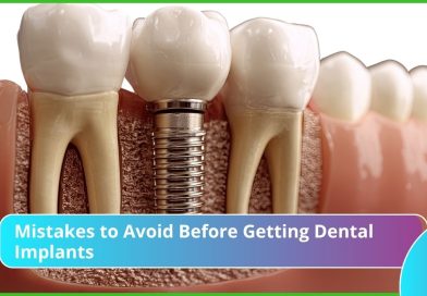 Mistakes to Avoid Before Getting Dental Implants
