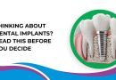 Thinking About Dental Implants? Read This Before You Decide