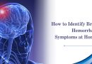 How to Identify Brain Hemorrhage Symptoms at Home?