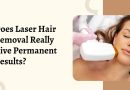 Does Laser Hair Removal Really Give Permanent Results?