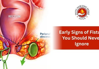 signs fistula never ignore