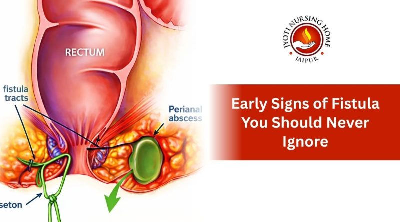 signs fistula never ignore