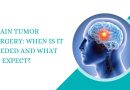Brain tumor surgery showing affected area of the brain