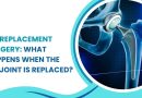 Hip Replacement Surgery showing artificial hip joint and replacement procedure