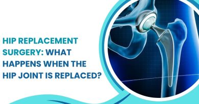 Hip Replacement Surgery showing artificial hip joint and replacement procedure