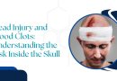 Head Injury and Blood Clots: Understanding the Risk Inside the Skull