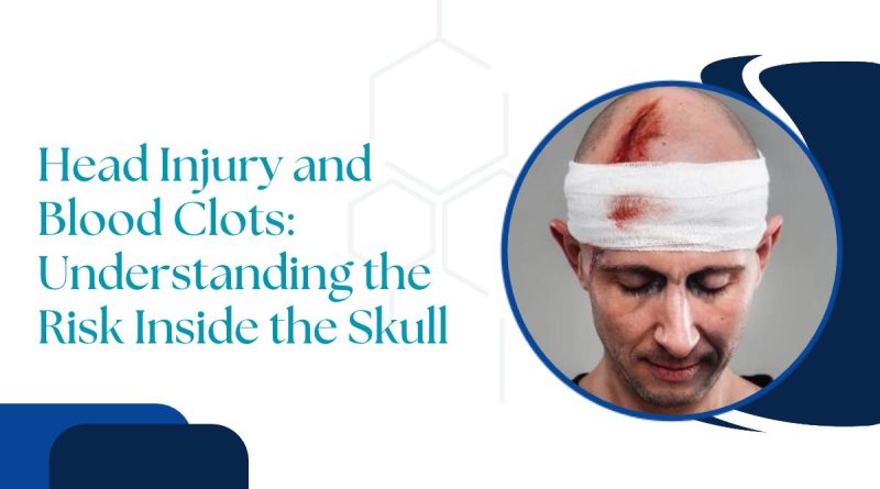 Head Injury and Blood Clots: Understanding the Risk Inside the Skull