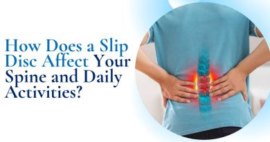 How Does a Slip Disc Affect Your Spine and Daily Activities?