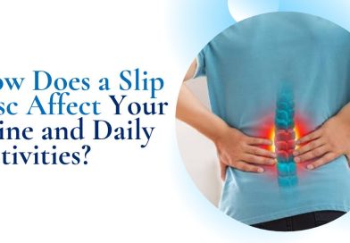 How Does a Slip Disc Affect Your Spine and Daily Activities?
