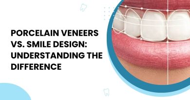 smile design doctor in Vaishali Nagar