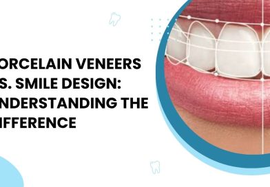 smile design doctor in Vaishali Nagar